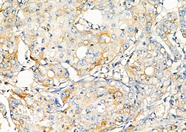 REM1 Antibody in Immunohistochemistry (Paraffin) (IHC (P))