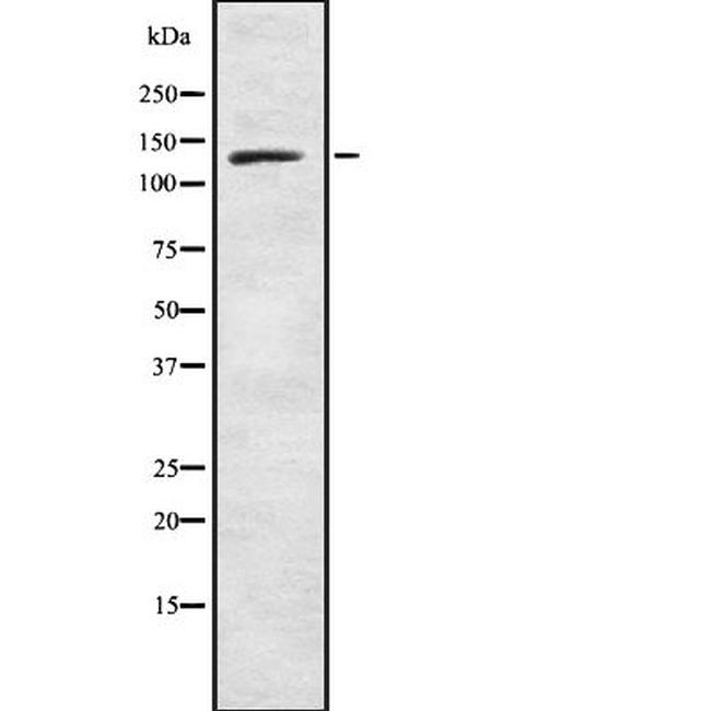 PLCB3 Antibody in Western Blot (WB)