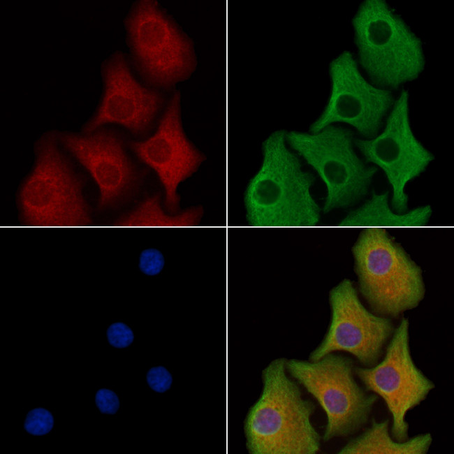 CAP2 Antibody in Immunocytochemistry (ICC/IF)