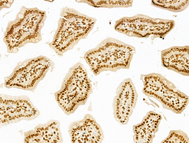 MCRS1 Antibody in Immunohistochemistry (Paraffin) (IHC (P))