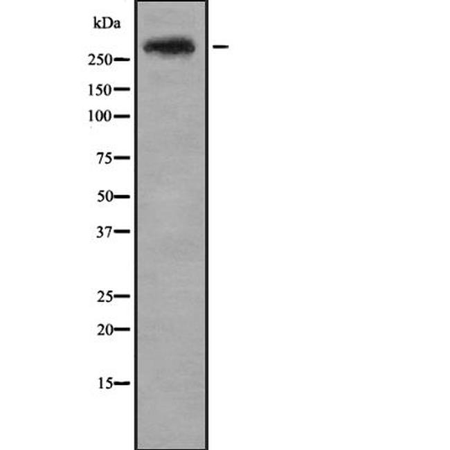 CENPE Antibody in Western Blot (WB)