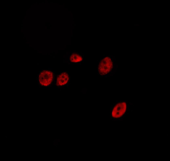 SENP2 Antibody in Immunocytochemistry (ICC/IF)