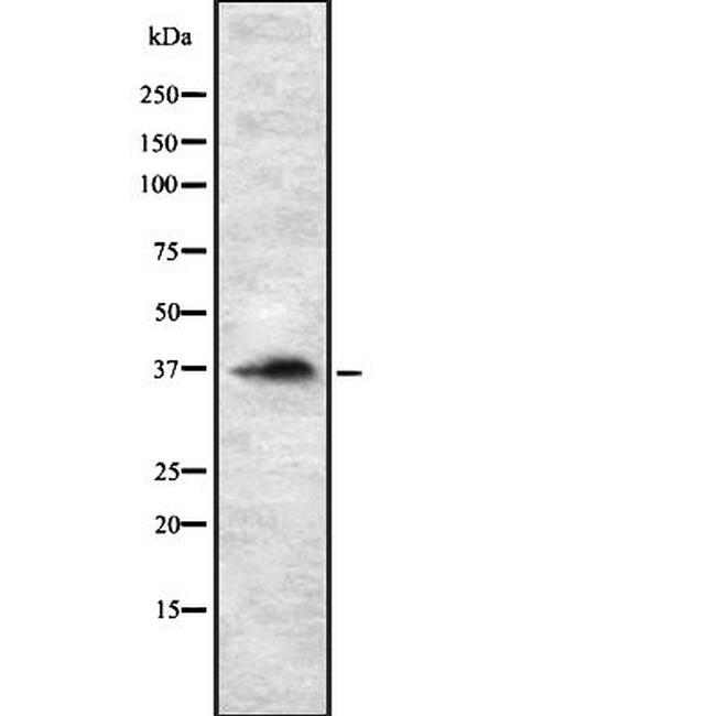 RASSF2 Antibody in Western Blot (WB)