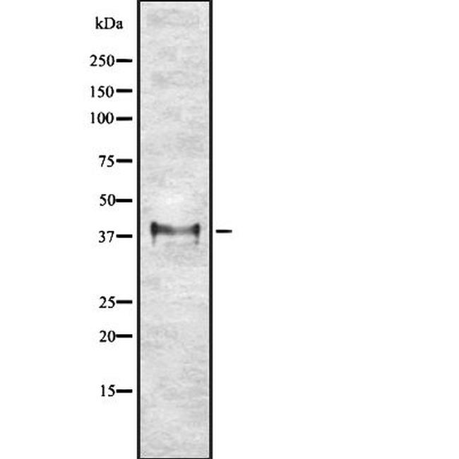 ETV2 Antibody in Western Blot (WB)