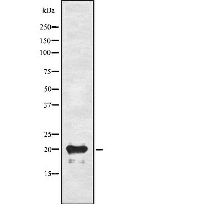 Adrenomedullin Antibody in Western Blot (WB)