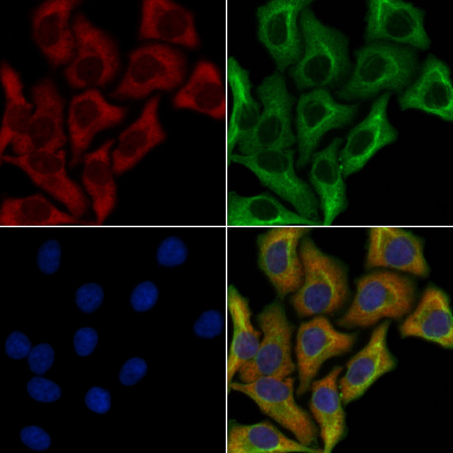 Ameloblastin Antibody in Immunocytochemistry (ICC/IF)