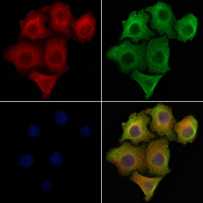 ATP5J2 Antibody in Immunocytochemistry (ICC/IF)
