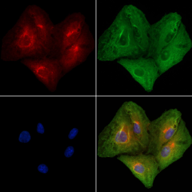 ATP7A Antibody in Immunocytochemistry (ICC/IF)