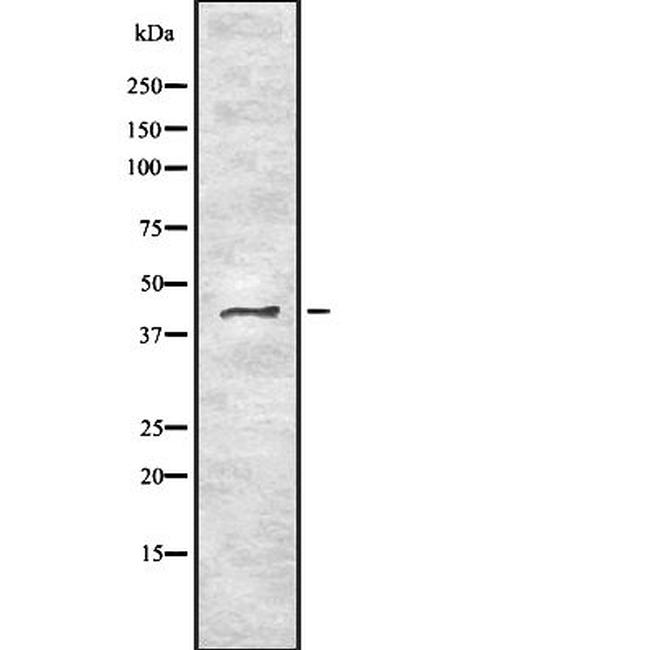 BMP-8 Antibody in Western Blot (WB)