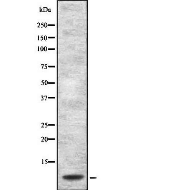 DEFA1 Antibody in Western Blot (WB)