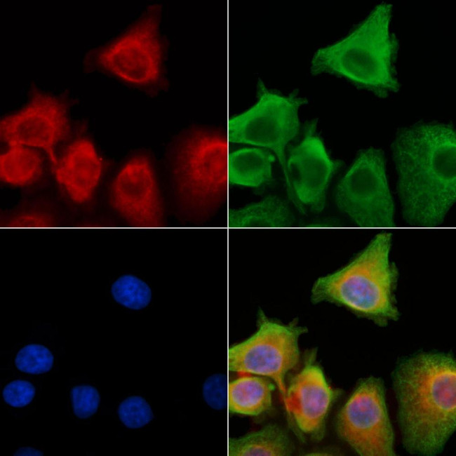 alpha-Defensin 3 Antibody in Immunocytochemistry (ICC/IF)