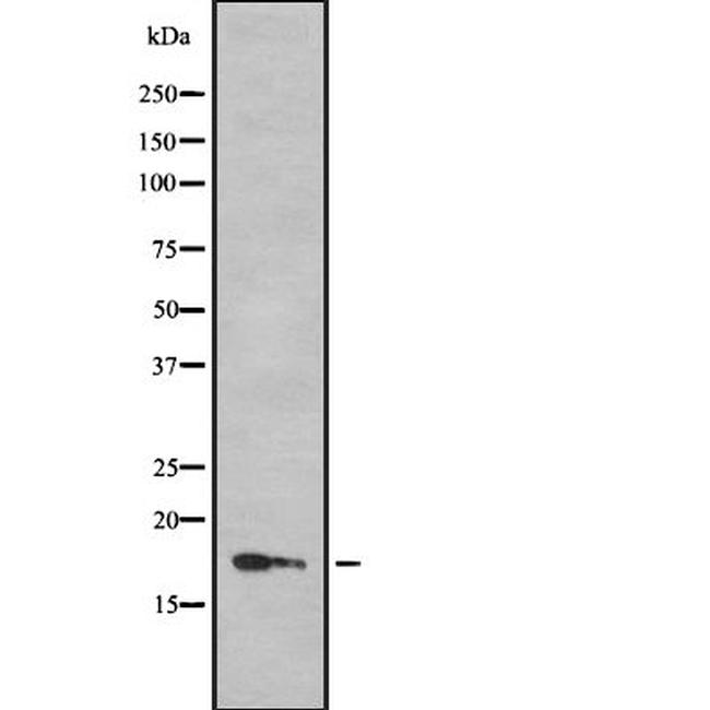 HES2 Antibody in Western Blot (WB)