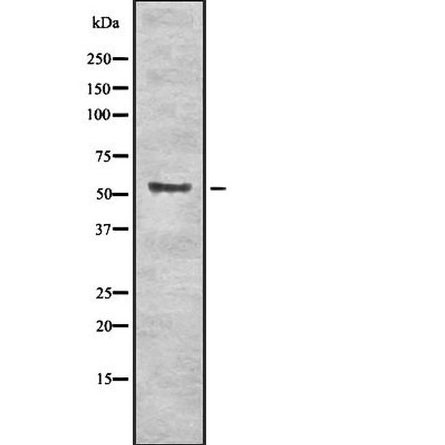 MST1/MST2 Antibody in Western Blot (WB)