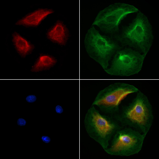 SCN8A Antibody in Immunocytochemistry (ICC/IF)