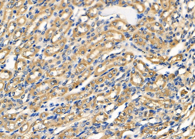 OCRL Antibody in Immunohistochemistry (Paraffin) (IHC (P))