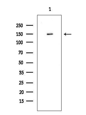 SGK223 Antibody in Western Blot (WB)