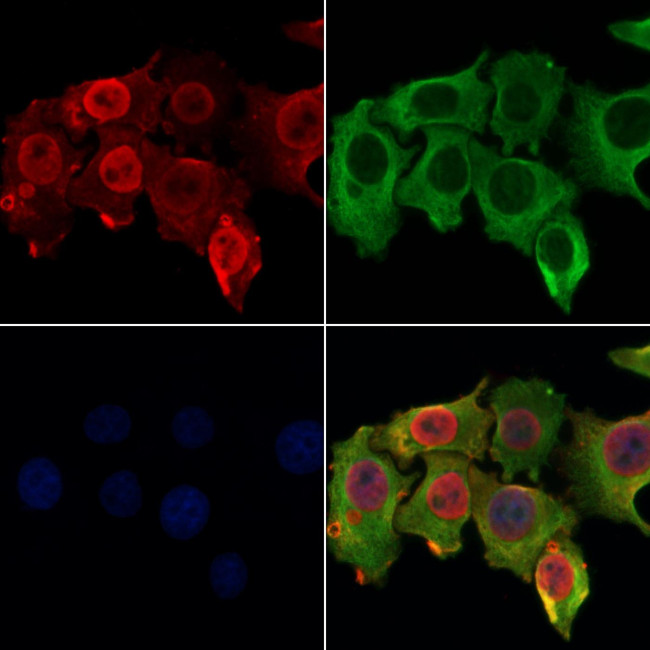 RPA4 Antibody in Immunocytochemistry (ICC/IF)