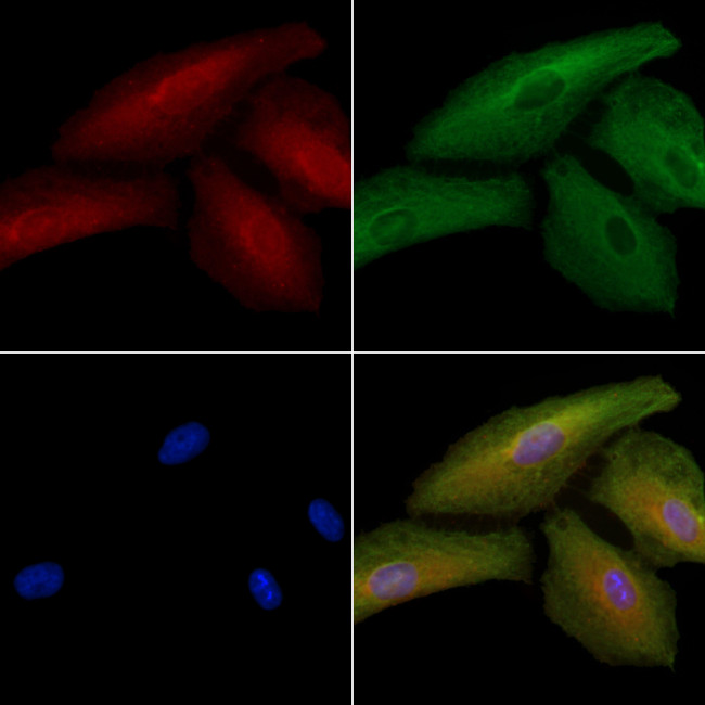 SGCB Antibody in Immunocytochemistry (ICC/IF)