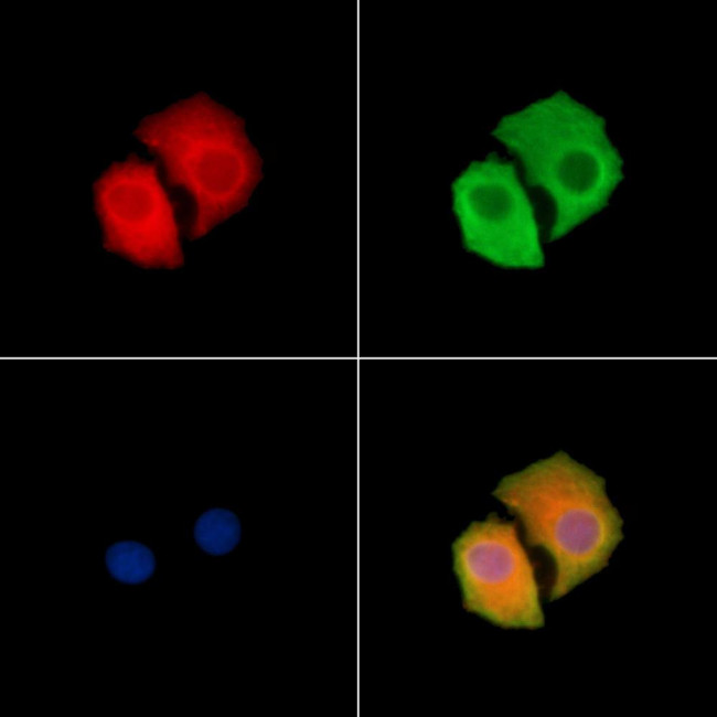Synphilin 1 Antibody in Immunocytochemistry (ICC/IF)