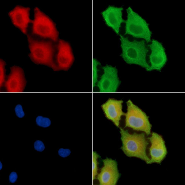 PRSS3 Antibody in Immunocytochemistry (ICC/IF)