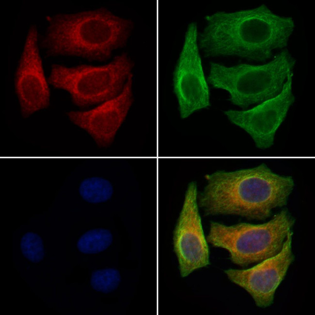 AWAT1 Antibody in Immunocytochemistry (ICC/IF)