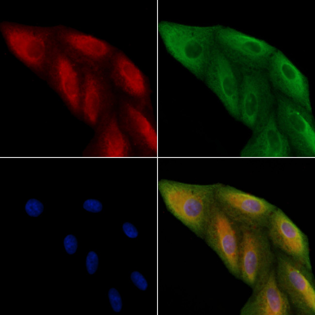 CYB561D2 Antibody in Immunocytochemistry (ICC/IF)