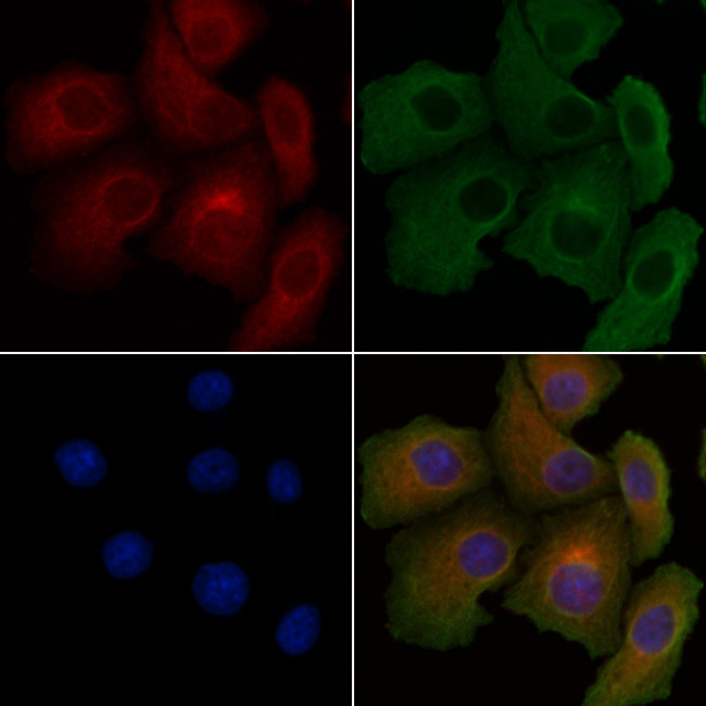 CARD10 Antibody in Immunocytochemistry (ICC/IF)