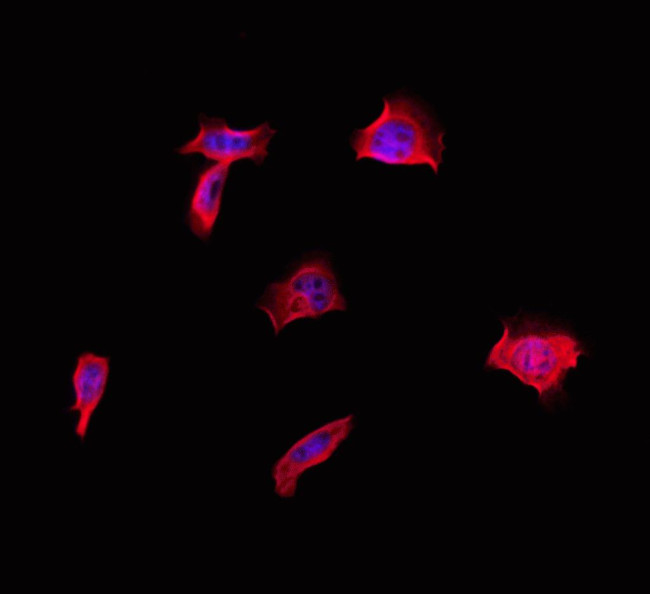 CD2BP2 Antibody in Immunocytochemistry (ICC/IF)