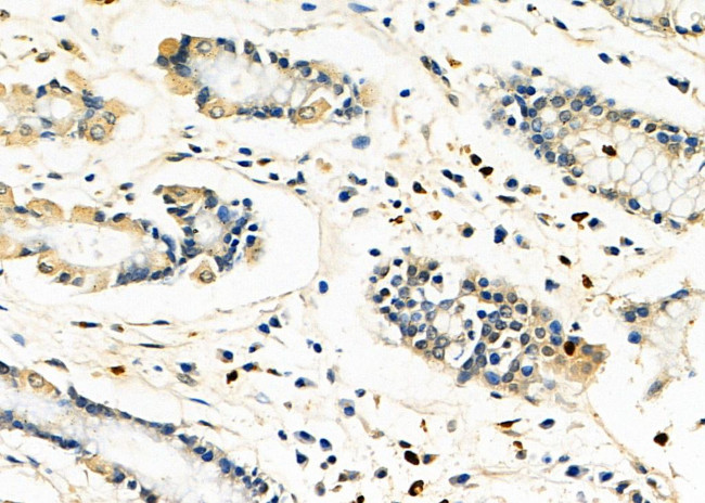 FASTKD2 Antibody in Immunohistochemistry (Paraffin) (IHC (P))