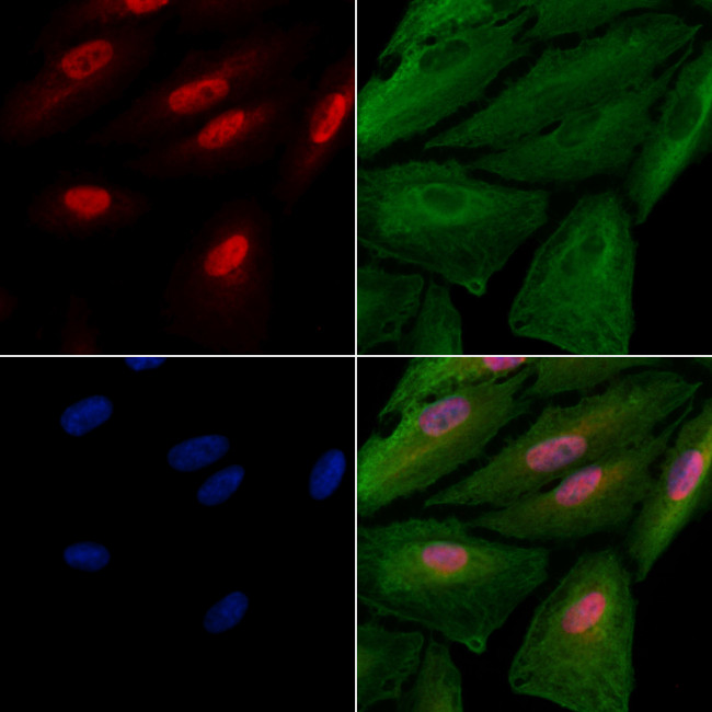 HES6 Antibody in Immunocytochemistry (ICC/IF)