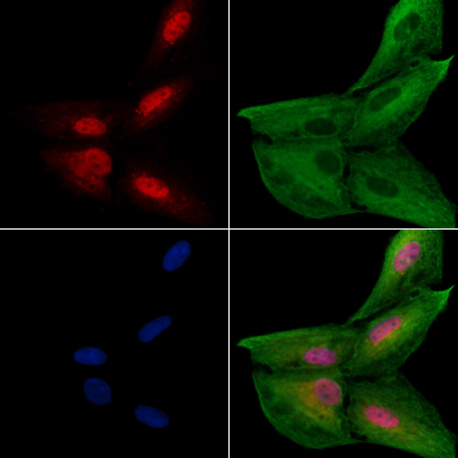 IP6K2 Antibody in Immunocytochemistry (ICC/IF)