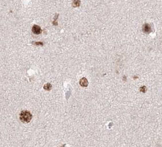 KIF20A Antibody in Immunohistochemistry (Paraffin) (IHC (P))