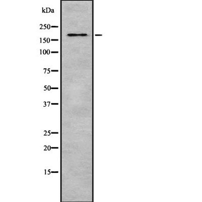 Laminin beta-2 Antibody in Western Blot (WB)