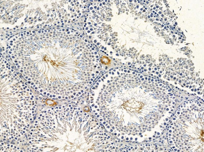 TNFRSF19L Antibody in Immunohistochemistry (Paraffin) (IHC (P))