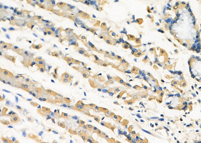 RIOK3 Antibody in Immunohistochemistry (Paraffin) (IHC (P))