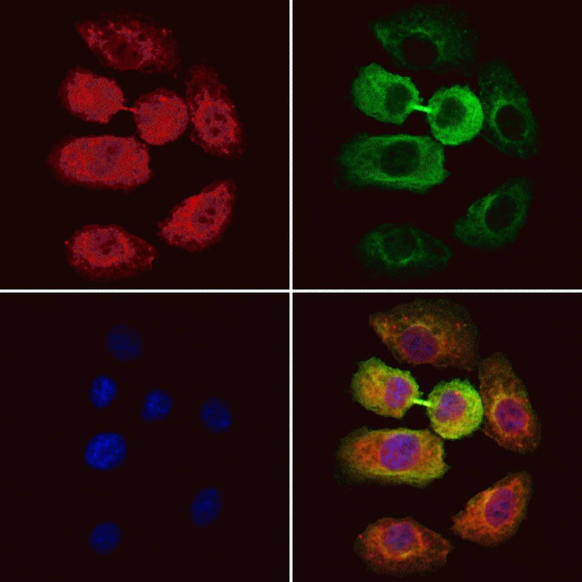 RMP Antibody in Immunocytochemistry (ICC/IF)