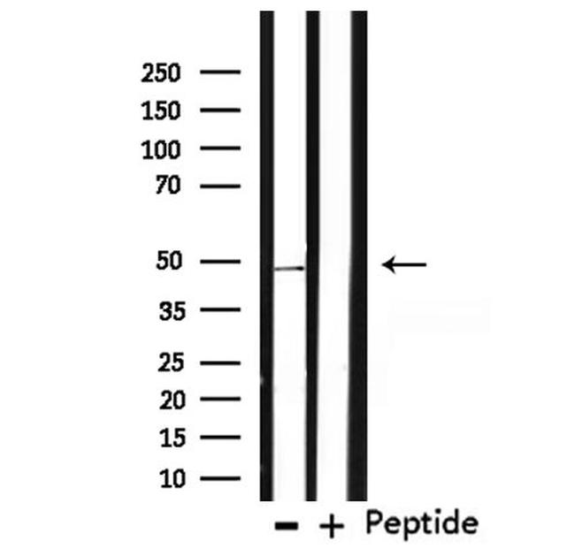 TMPRSS3 Antibody in Western Blot (WB)