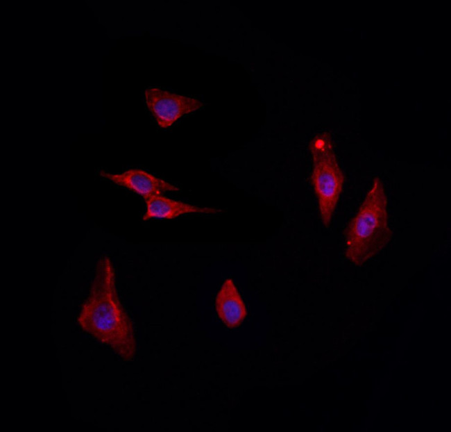 UBTD2 Antibody in Immunocytochemistry (ICC/IF)