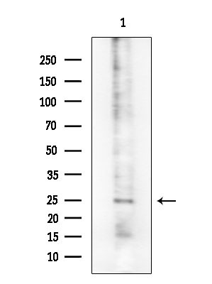 Phospho-CD28 (Tyr218) Antibody in Western Blot (WB)