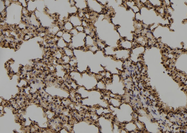 Phospho-RRN3 (Ser649) Antibody in Immunohistochemistry (Paraffin) (IHC (P))