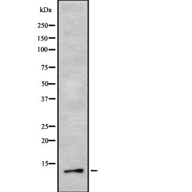 MT-ND3 Antibody in Western Blot (WB)