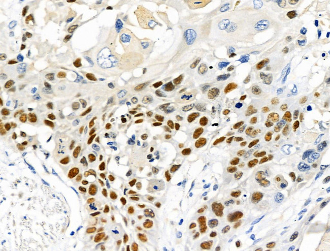 SUMO2/SUMO3/SUMO4 Antibody in Immunohistochemistry (Paraffin) (IHC (P))