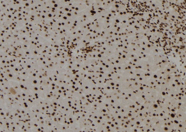 TGIF2LY Antibody in Immunohistochemistry (Paraffin) (IHC (P))