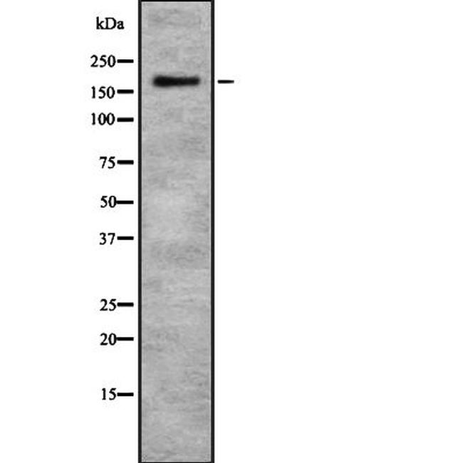 CHD1 Antibody in Western Blot (WB)
