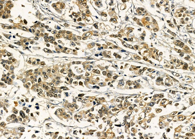 SAP30 Antibody in Immunohistochemistry (Paraffin) (IHC (P))