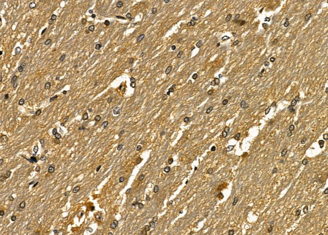 SNAPC5 Antibody in Immunohistochemistry (Paraffin) (IHC (P))
