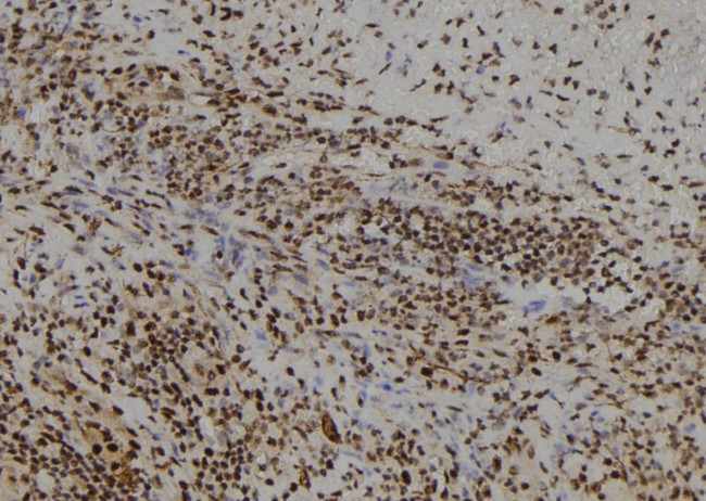 FSBP Antibody in Immunohistochemistry (Paraffin) (IHC (P))