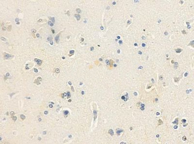 ANP32D Antibody in Immunohistochemistry (IHC)