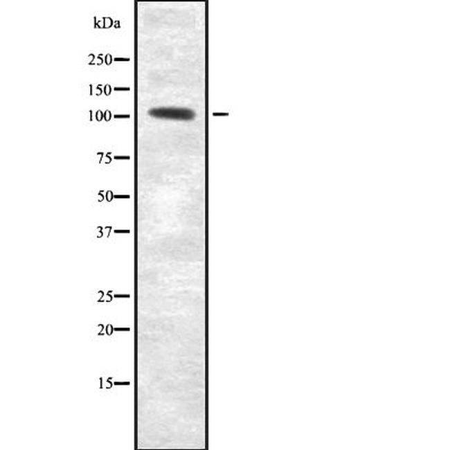 RECK Antibody in Western Blot (WB)