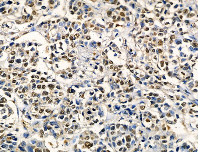 ZNF7 Antibody in Immunohistochemistry (Paraffin) (IHC (P))
